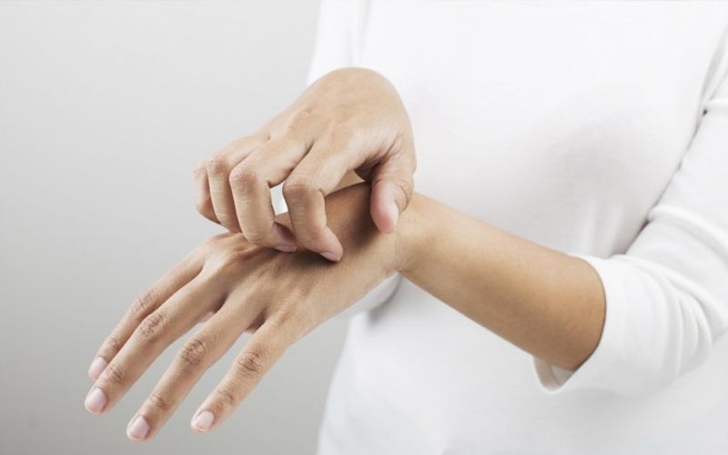 Cảm giác ngứa ngáy, châm chích ở vùng da đeo nhẫn là triệu chứng phổ biến nhất khi bị dị ứng