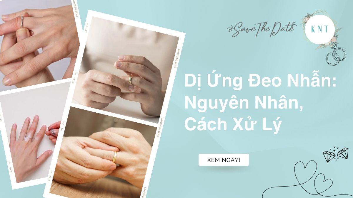 Dị Ứng Đeo Nhẫn: Nguyên Nhân, Cách Xử Lý & Bí Quyết Chọn Nhẫn An Toàn