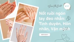 Nốt ruồi ngón tay đeo nhẫn: Tình duyên, Hôn nhân, Vận mệnh