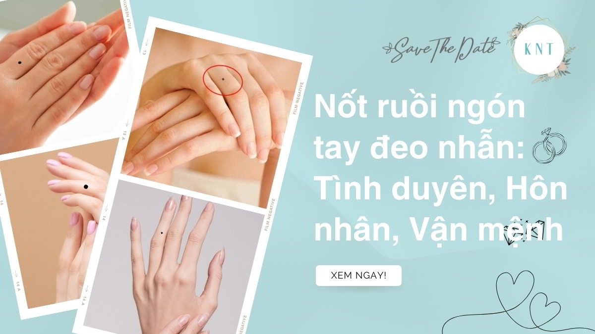 Nốt ruồi ngón tay đeo nhẫn: Tình duyên, Hôn nhân, Vận mệnh